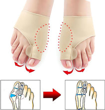 Load image into Gallery viewer, Orthopedic Toe Straightener with a Massage Ball