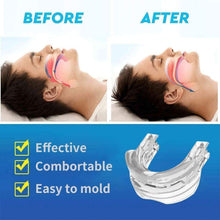 Load image into Gallery viewer, Anti Snoring Sleep Apnea Mouthpiece Guard
