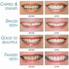 Load image into Gallery viewer, Smile Veneers (Upper & Lower)