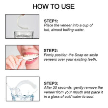 Load image into Gallery viewer, Smile Veneers (Upper & Lower)