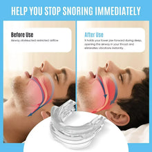 Load image into Gallery viewer, Anti Snoring Sleep Apnea Mouthpiece Guard
