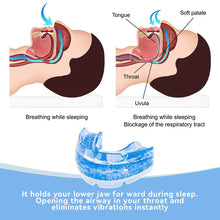 Load image into Gallery viewer, Adjustable Anti Snore Mouthpiece

